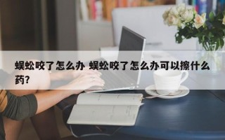 蜈蚣咬了怎么办 蜈蚣咬了怎么办可以擦什么药？