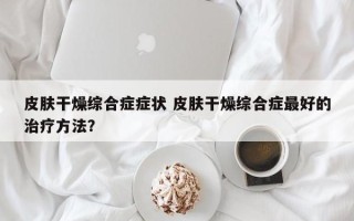 皮肤干燥综合症症状 皮肤干燥综合症最好的治疗方法？