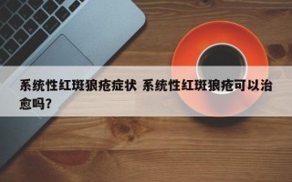 系统性红斑狼疮症状 系统性红斑狼疮可以治愈吗？