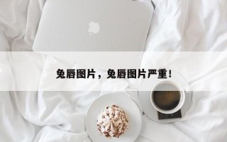 兔唇图片，兔唇图片严重！