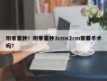 附睾囊肿！附睾囊肿3cmx2cm需要手术吗？