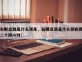 右眼皮跳是什么预兆，右眼皮跳是什么预兆男二十四小时！