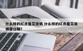 什么样的红点是艾滋病 什么样的红点是艾滋病窗口期？