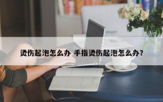 烫伤起泡怎么办 手指烫伤起泡怎么办？