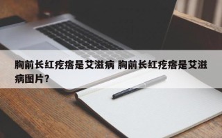 胸前长红疙瘩是艾滋病 胸前长红疙瘩是艾滋病图片？