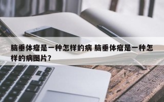 脑垂体瘤是一种怎样的病 脑垂体瘤是一种怎样的病图片？