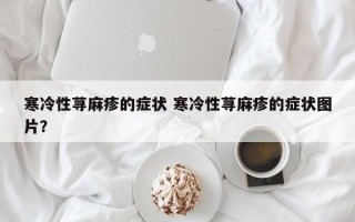 寒冷性荨麻疹的症状 寒冷性荨麻疹的症状图片？