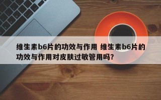 维生素b6片的功效与作用 维生素b6片的功效与作用对皮肤过敏管用吗？