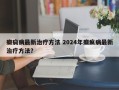 癫痫病最新治疗方法 2024年癫疯病最新治疗方法？