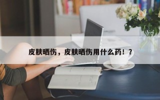 皮肤晒伤，皮肤晒伤用什么药！？