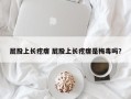 屁股上长疙瘩 屁股上长疙瘩是梅毒吗？