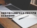 手脚出汗是什么原因?怎么治 手脚出汗严重怎么治才能除根？