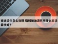 被油烫伤怎么处理 胳膊被油烫伤用什么方法最快好？