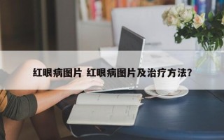 红眼病图片 红眼病图片及治疗方法？