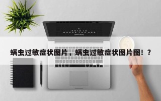 螨虫过敏症状图片，螨虫过敏症状图片图！？