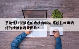 系统性红斑狼疮的症状有哪些 系统性红斑狼疮的症状有哪些图片？