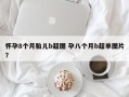 怀孕8个月胎儿b超图 孕八个月b超单图片？