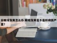 白眼球发黄怎么办 眼睛发黄是不是肝病很严重？