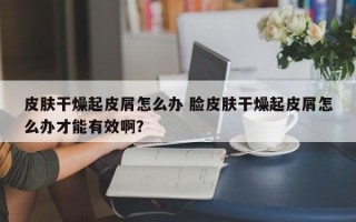 皮肤干燥起皮屑怎么办 脸皮肤干燥起皮屑怎么办才能有效啊？