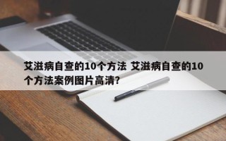 艾滋病自查的10个方法 艾滋病自查的10个方法案例图片高清？